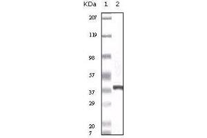Western blot analysis using calcyclin mouse mAb against truncated calcyclin recombinant protein. (S100A6 antibody)