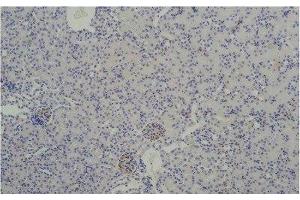 Immunohistochemistry of paraffin-embedded Mouse kidney tissue using TBP Monoclonal Antibody at dilution of 1:200. (TBP antibody)