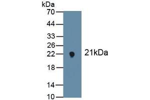 Detection of Recombinant NOX4, Mouse using Polyclonal Antibody to NADPH Oxidase 4 (NOX4) (NADPH Oxidase 4 antibody  (AA 210-578))