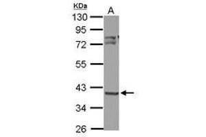 Image no. 3 for anti-3-Oxoacyl-ACP Synthase, Mitochondrial (OXSM) (AA 234-423) antibody (ABIN1501992) (OXSM antibody  (AA 234-423))