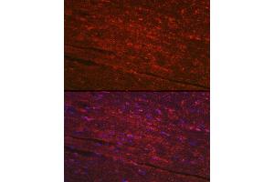 Immunofluorescence analysis of mouse heart using PG Rabbit pAb (ABIN6132481, ABIN6145500, ABIN6145501 and ABIN6223912) at dilution of 1:100 (40x lens). (PGAM2 antibody  (AA 1-253))