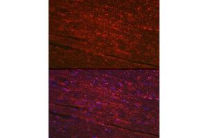 Immunofluorescence analysis of mouse heart using PG Rabbit pAb (ABIN6132481, ABIN6145500, ABIN6145501 and ABIN6223912) at dilution of 1:100 (40x lens). (PGAM2 antibody  (AA 1-253))