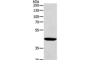Western Blot analysis of Human lymphoma tissue using SOX-7 Polyclonal Antibody at dilution of 1:1100 (SOX7 antibody)