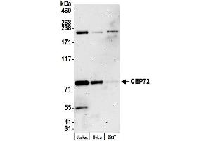 anti-Centrosomal Protein 72kDa (CEP72) (AA 150-200) antibody