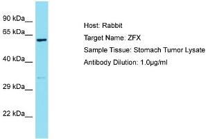 Host: Rabbit Target Name: ZFX Sample Type: Stomach Tumor lysates Antibody Dilution: 1. (ZFX antibody  (C-Term))