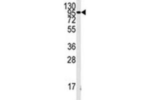 Western blot analysis of FGFR antibody and K562 lysate. (FGFR1 antibody  (AA 132-161))