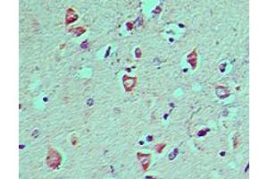 ATG8 Immunohistochemistry. (MAP1LC3A antibody  (N-Term))