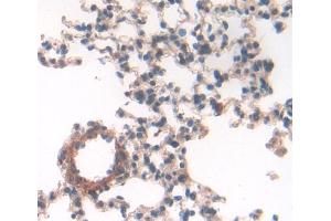 Used in DAB staining on fromalin fixed paraffin- embedded lung tissue (GM-CSF antibody  (AA 19-141))