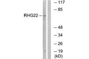 Western blot analysis of extracts from K562 cells, using RHG22 Antibody.