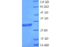 Guanidinoacetate N-Methyltransferase (GAMT) (AA 1-236) protein (His tag) expressed in E.