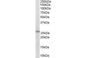 Western Blotting (WB) image for anti-Glutathione S-Transferase mu 1/2 (GSTM1/2) (C-Term) antibody (ABIN393122) (GSTM1/2 antibody  (C-Term))
