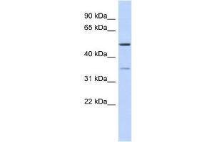 WB Suggested Anti-CETP Antibody Titration: 0. (CETP antibody  (Middle Region))
