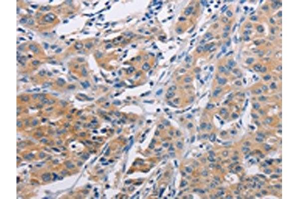 AGBL5 antibody