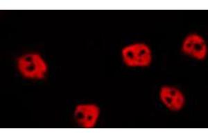 ABIN6274015 staining HepG2 by IF/ICC. (EPAS1 antibody  (Internal Region))