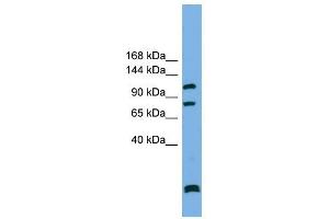 PPP6R1 antibody used at 1 ug/ml to detect target protein. (SAPS1 antibody  (N-Term))