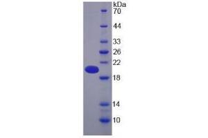Image no. 1 for Pregnancy Zone Protein (PZP) (AA 1212-1391) protein (His tag) (ABIN1171180) (PZP Protein (AA 1212-1391) (His tag))