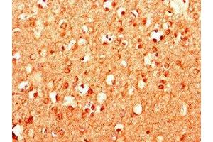 Immunohistochemistry of paraffin-embedded human brain tissue using ABIN7158987 at dilution of 1:100 (MPDU1 antibody  (AA 1-36))