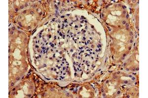Immunohistochemistry of paraffin-embedded human kidney tissue using ABIN7174772 at dilution of 1:100 (NMNAT2 antibody  (AA 1-183))