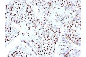 FFPE human testicular carcinoma tested with Histone antibody (AE-4) (Histone antibody)