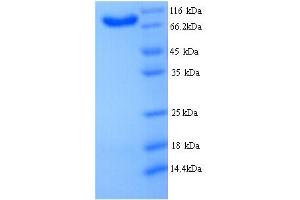 SDS-PAGE (SDS) image for B-Cell Scaffold Protein with Ankyrin Repeats 1 (BANK1) (AA 1-785), (full length) protein (His tag) (ABIN5714428) (BANK1 Protein (AA 1-785, full length) (His tag))