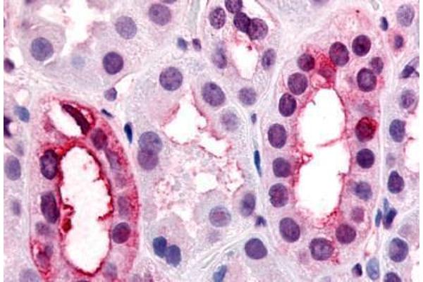 VN1R1 antibody  (Extracellular Domain)