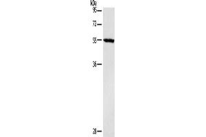 Gel: 10 % SDS-PAGE, Lysate: 40 μg, Lane: Mouse heart tissue, Primary antibody: ABIN7190465(DGAT1 Antibody) at dilution 1/1400, Secondary antibody: Goat anti rabbit IgG at 1/8000 dilution, Exposure time: 40 seconds (DGAT1 antibody)