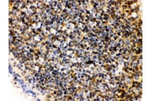 IHC testing of FFPE rat lymph node with PLK1 antibody. (PLK1 antibody  (AA 86-430))