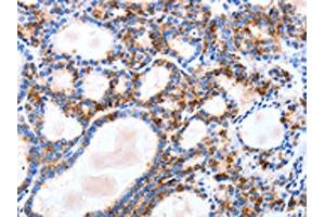 IGSF6 antibody