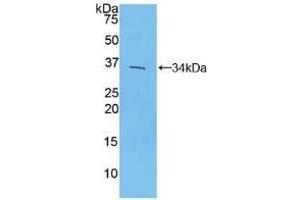 Detection of Recombinant IRF4, Mouse using Polyclonal Antibody to Interferon Regulatory Factor 4 (IRF4) (IRF4 antibody  (AA 175-433))