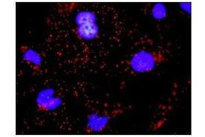 Immunofluorescence (IF) image for anti-Cadherin 1, Type 1, E-Cadherin (Epithelial) (CDH1) (AA 381-481) antibody (ABIN614587)