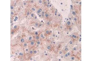 Used in DAB staining on fromalin fixed paraffin- embedded liver tissue (ACAA1 antibody  (AA 182-424))
