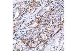 IHC analysis of Rab4/RAB4A using anti-Rab4/RAB4A antibody (ABIN7599733). (Rab4 antibody  (AA 110-216))