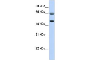 WB Suggested Anti-FAM113A Antibody Titration:  0.