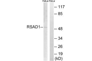 Western blot analysis of extracts from HeLa cells, using RSAD1 antibody. (RSAD1 antibody  (Internal Region))