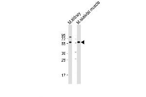 Western Blot at 1:1000 dilution Lane 1: mouse kidney lysate Lane 2: mouse skeletal muscle lysate Lysates/proteins at 20 ug per lane. (ACVR2B antibody  (AA 148-176))