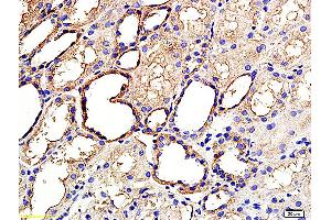 Formalin-fixed and paraffin embedded human kidney labeled with Anti ANGPTL3/ANG5 Polyclonal Antibody, Unconjugated (ABIN759806) at 1:200 followed by conjugation to the secondary antibody and DAB staining (ANGPTL3 antibody  (AA 21-120))