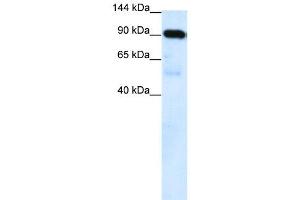 WB Suggested Anti-SUV420H1  Antibody Titration: 0. (SUV420H1 antibody  (Middle Region))