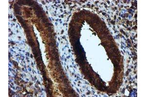 Immunohistochemical staining of paraffin-embedded Human endometrium tissue using anti-KEAP1 mouse monoclonal antibody. (KEAP1 antibody)