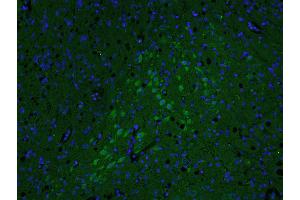 Paraformaldehyde-fixed, paraffin embedded rat brain; Antigen retrieval by boiling in sodium citrate buffer (pH6. (AKAP12 antibody  (AA 701-900))