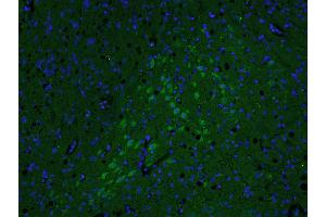 Paraformaldehyde-fixed, paraffin embedded rat brain; Antigen retrieval by boiling in sodium citrate buffer (pH6. (AKAP12 antibody  (AA 701-900))