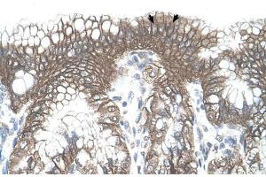 Human Stomach (TARS antibody  (N-Term))