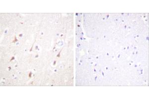 Peptide - +Immunohistochemistry analysis of paraffin-embedded human brain tissue using IRS-1 antibody. (IRS1 antibody)