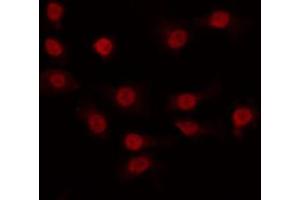 ABIN6266900 staining COLO by IF/ICC. (CDK11 antibody  (Internal Region))