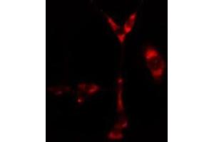 ABIN6276665 staining  Hela cells by IF/ICC. (CYP1B1 antibody  (Internal Region))