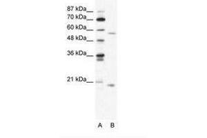 Image no. 1 for anti-Zinc Finger Protein 18 (ZNF18) (N-Term) antibody (ABIN202745) (ZNF18 antibody  (N-Term))