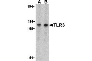 Western Blotting (WB) image for anti-Toll-Like Receptor 3 (TLR3) (C-Term) antibody (ABIN1030743) (TLR3 antibody  (C-Term))
