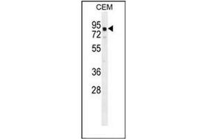 Western blot analysis of GLB1L2 Antibody (C-term) in CEM cell line lysates (35ug/lane). (GLB1L2 antibody  (C-Term))