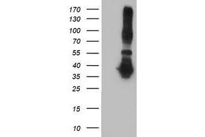 HEK293T cells were transfected with the pCMV6-ENTRY control (Left lane) or pCMV6-ENTRY ANKRD53 (Right lane) cDNA for 48 hrs and lysed. (ANKRD53 antibody  (AA 1-300))