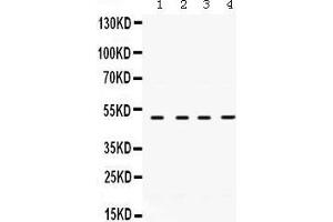 Western Blotting (WB) image for anti-Ribonucleotide Reductase M2 (RRM2) (AA 1-33), (N-Term) antibody (ABIN3043425) (RRM2 antibody  (N-Term))