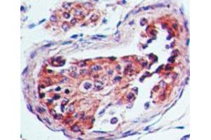 Serotonin Receptor 3A Immunohistochemistry. (Serotonin Receptor 3A antibody)